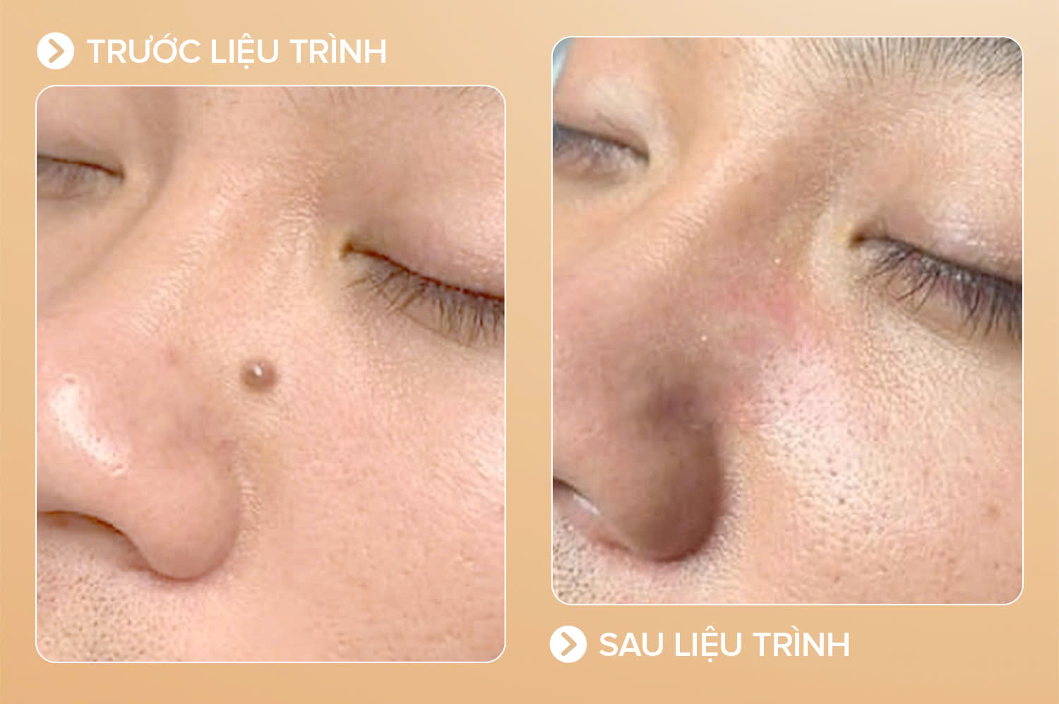 z7077300502030_bf77d4fa8a9334de8811e024eacffab5