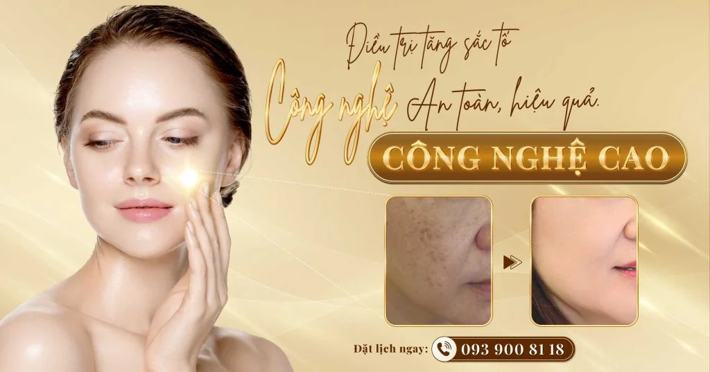 Điều trị tăng sắc tố da