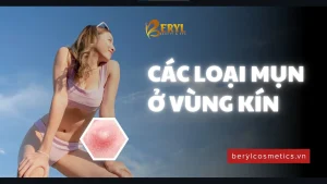 Mụn ở vùng kín