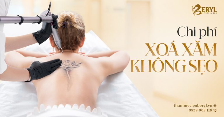 Chi phí xoá xăm 2025