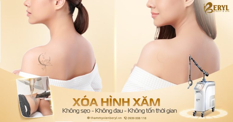 Xoá xăm không sẹo