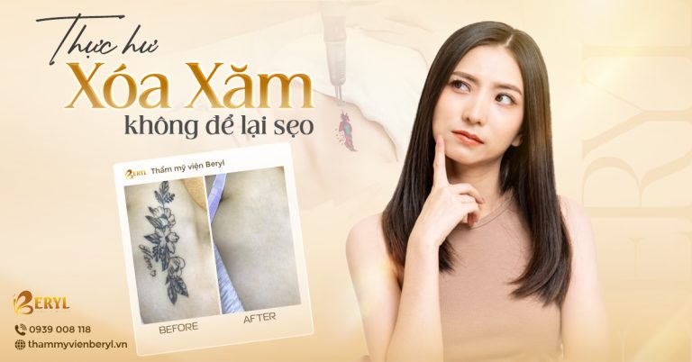 Xoá xăm không sẹo