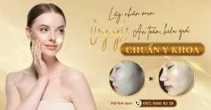 Lấy nhân mụn