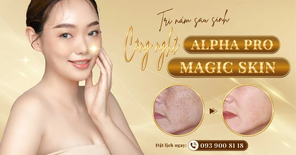 trị nám sau sinh