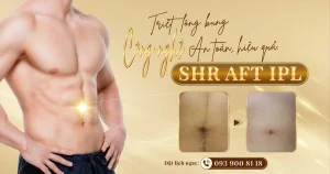 Triệt lông bụng